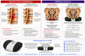 MALMSTOLEN Coccyx istuin -lis�varuste